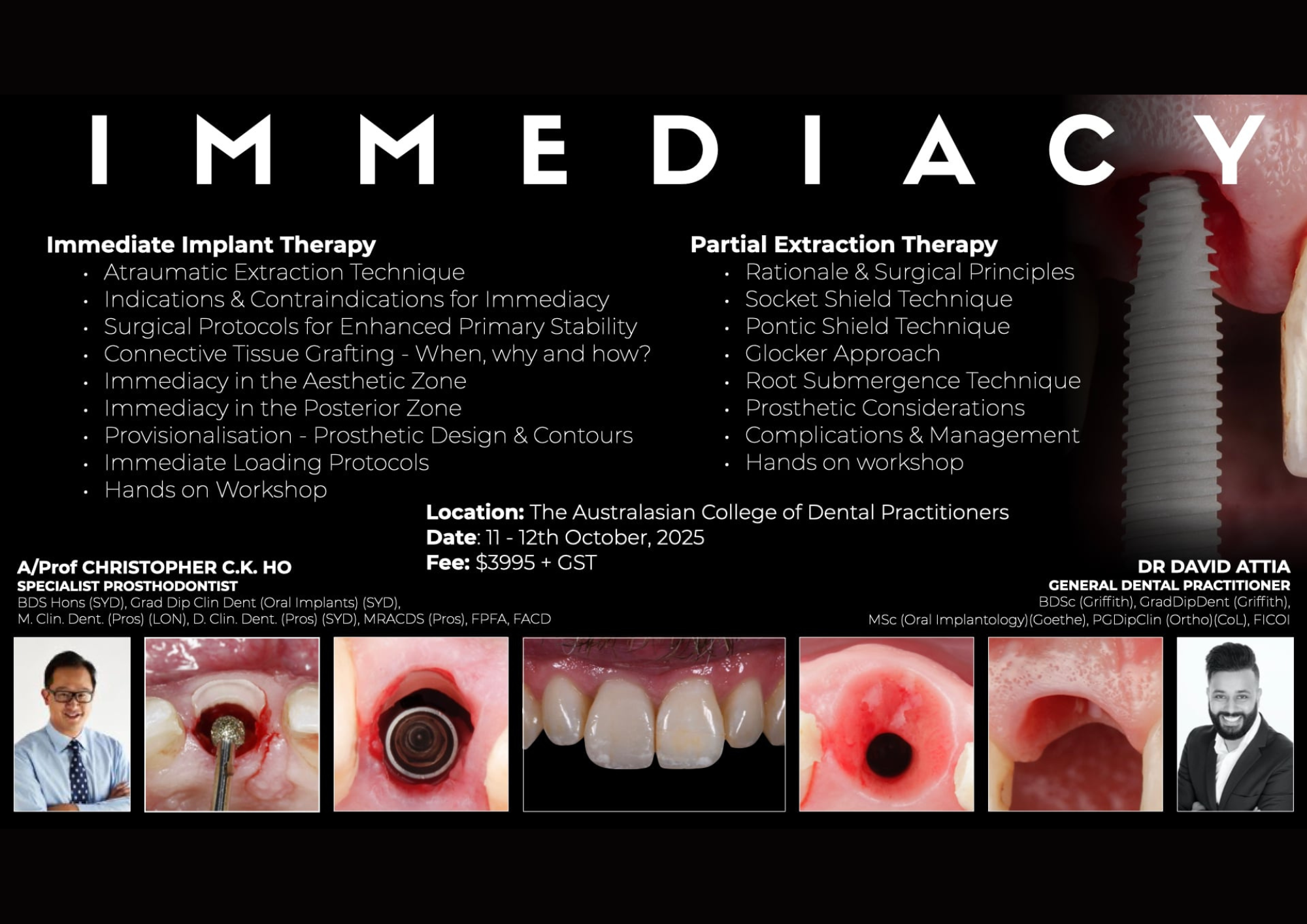 オルソインプラントセラピー 【裁断済み】オルソインプラントセラピー